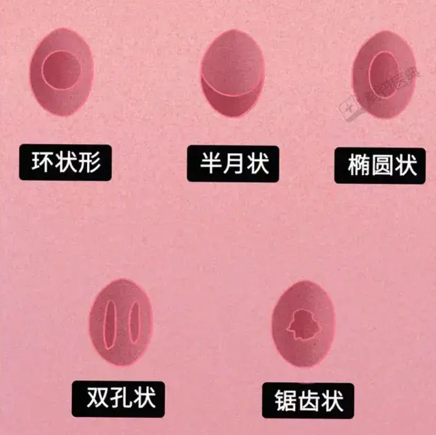 图片来源：腾讯医典
