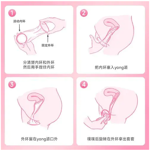 女用套套方法
