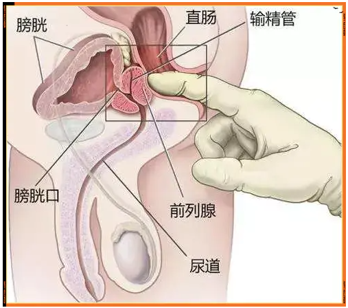 男生的G点——前列腺