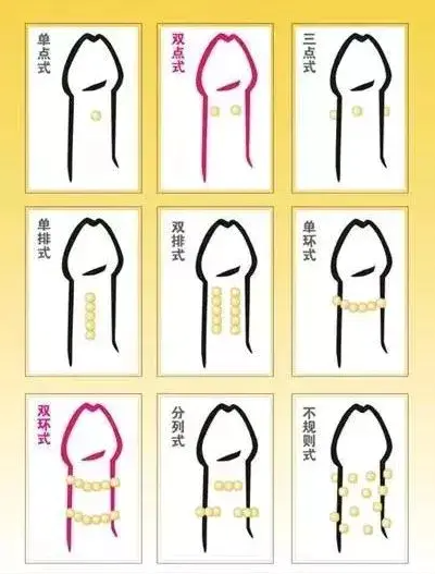 镶珠