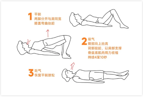 凯格尔运动