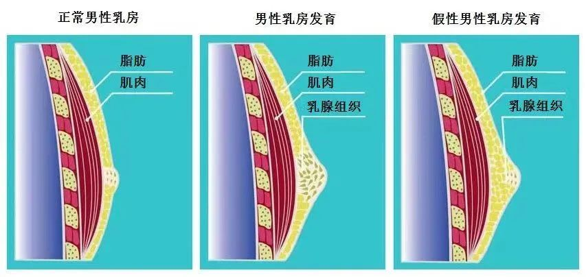 雌化
