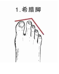 希腊脚