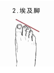 埃及脚
