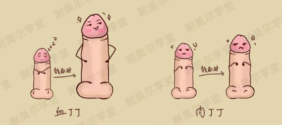 丁丁的弹性不同