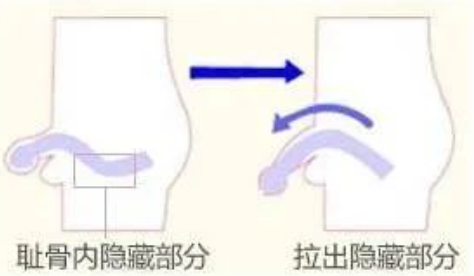 丁丁增长术,靠谱吗