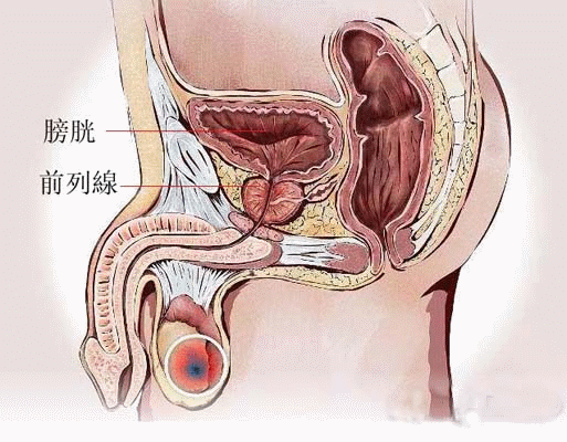 养护前列腺,男人更健康