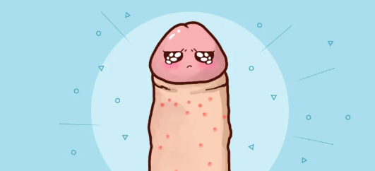 丁丁上有小疙瘩？这是病吗...