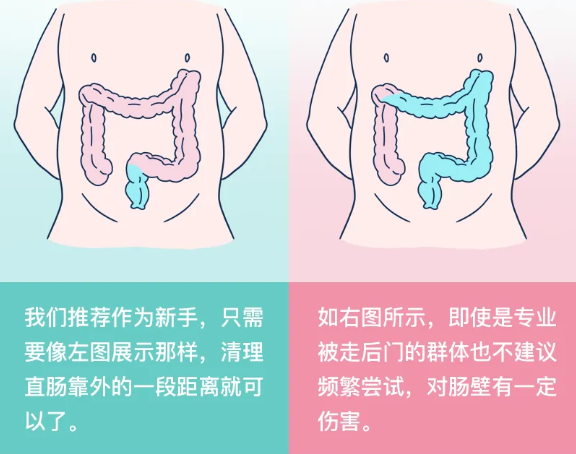 走后门一定要灌肠吗