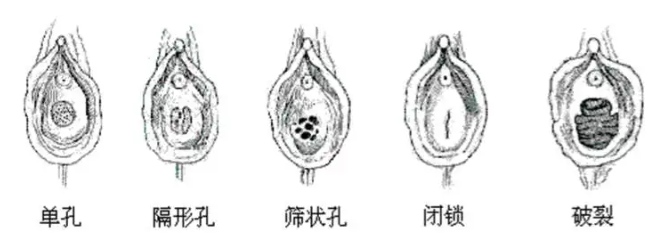 处女可以享受情趣玩具带来的乐趣吗