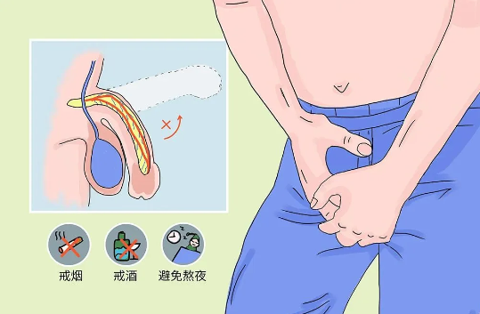 性生活时硬不起来或是容易软?我来给你支招