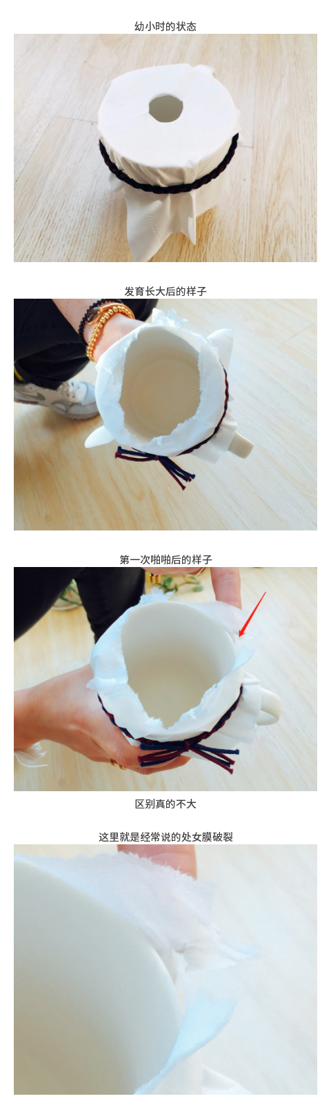 简单科普:处女膜到底是不是个“膜”?