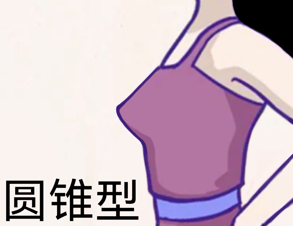 胸部原来有这么多形状!