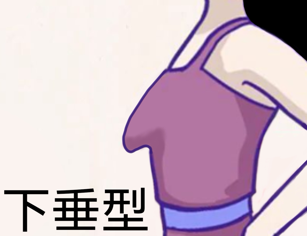 胸部原来有这么多形状!