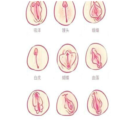 私处这样正常吗?原来那里有这么多形状