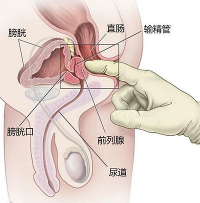 指检后,打开了新世界的大门……