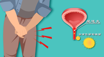 做爱时阴茎疼怎么回事怎么办