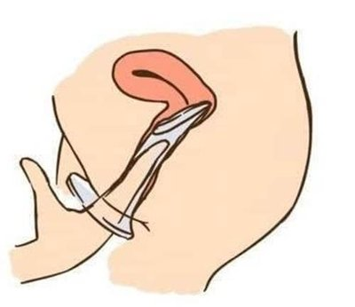 竟然有人对乳胶过敏！没关系，小雨伞还有这些材质