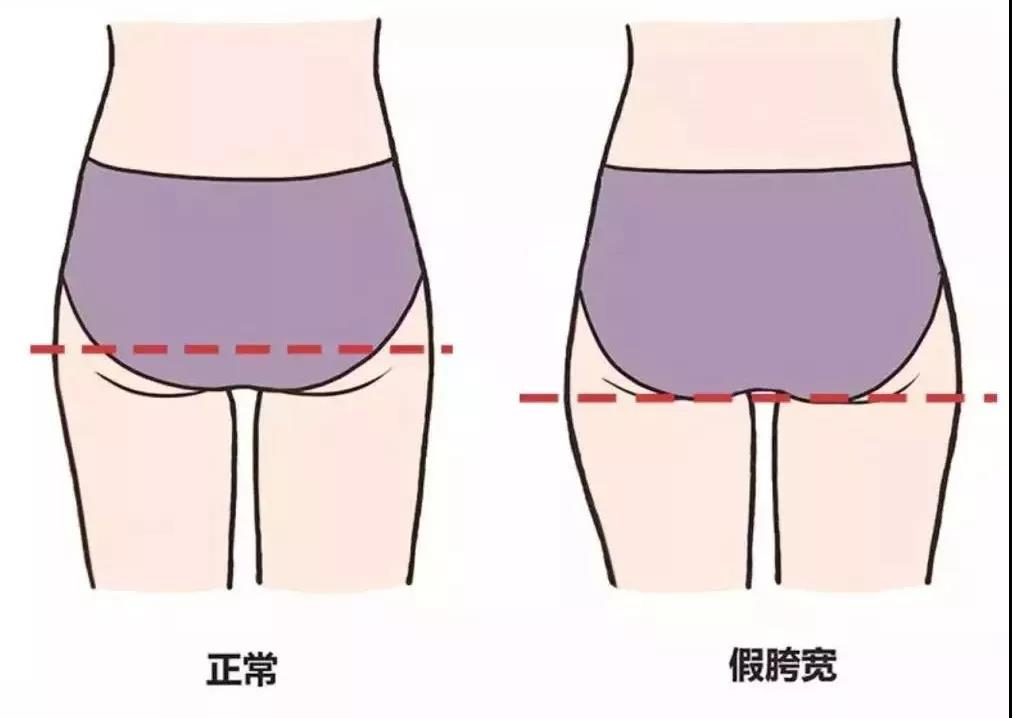 屁股为什么越来越大！