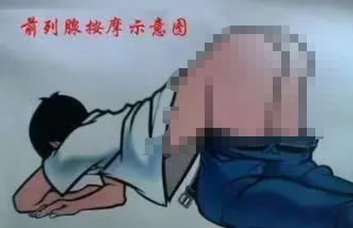 怎样检查男生的前列腺!