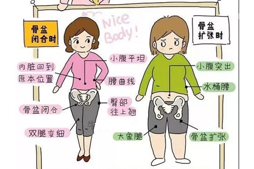 盆骨修复有必要吗？图文详解