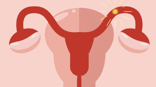 更年期女性该如何调整养生方案?需避开哪些误区?