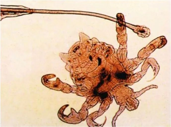 天呐，私处居然还会长虫子？