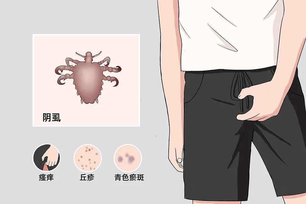 天呐，私处居然还会长虫子？