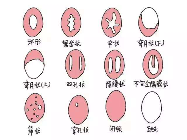形状也各异