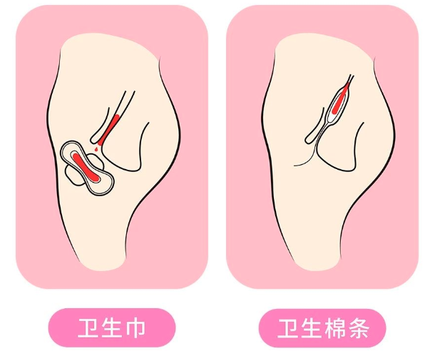 卫生棉条