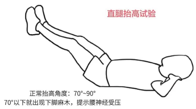 直腿抬高试验