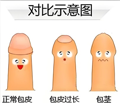 男人龟的头部有白色污垢怎么办
