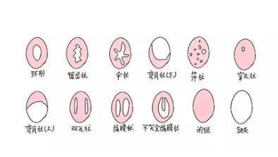 卫生棉条怎么用?卫生棉条比你想的好用多了