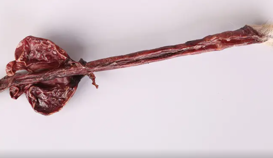 男士修复海绵体真有用么