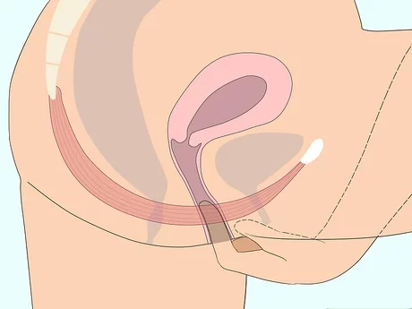 凯格尔运动怎么做