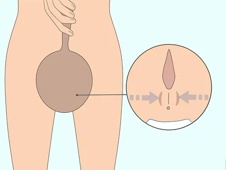 凯格尔运动怎么做