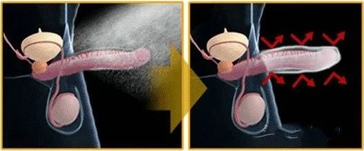 ▲起效原理示意图